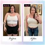 Wegovy Before and After: Transformations, Benefits, and Insights